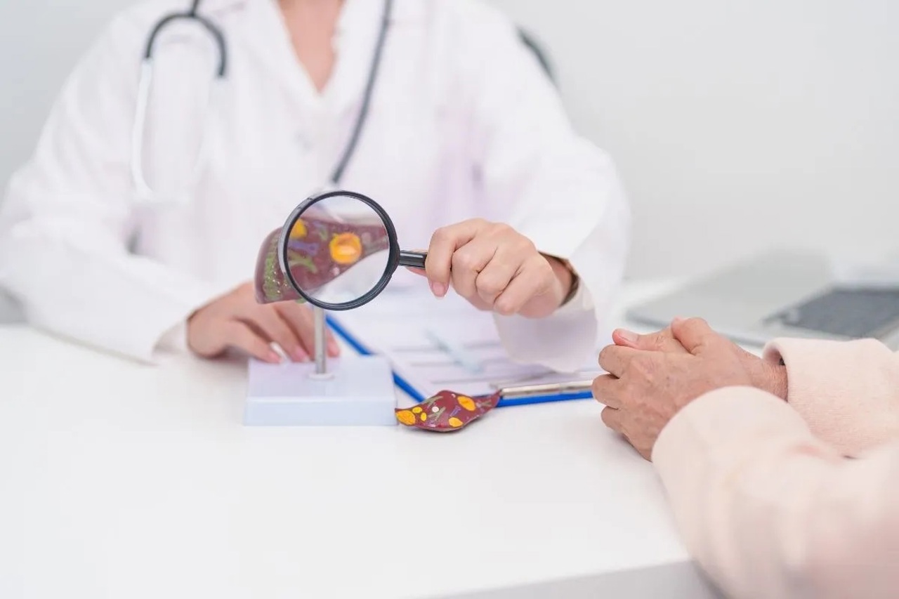 Hepatita cronică poate duce la ciroză în aproximativ zece ani, avertizează medicii