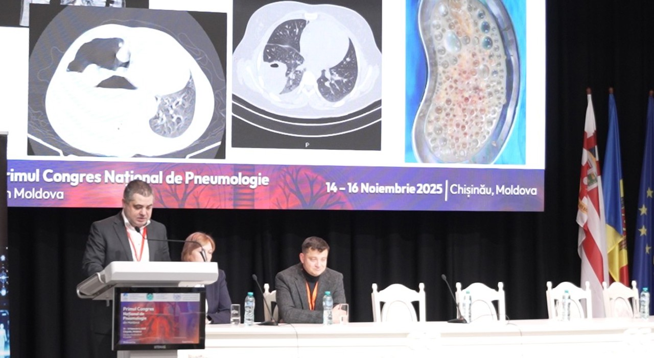 Chișinău hosts major congress on global respiratory disease prevention