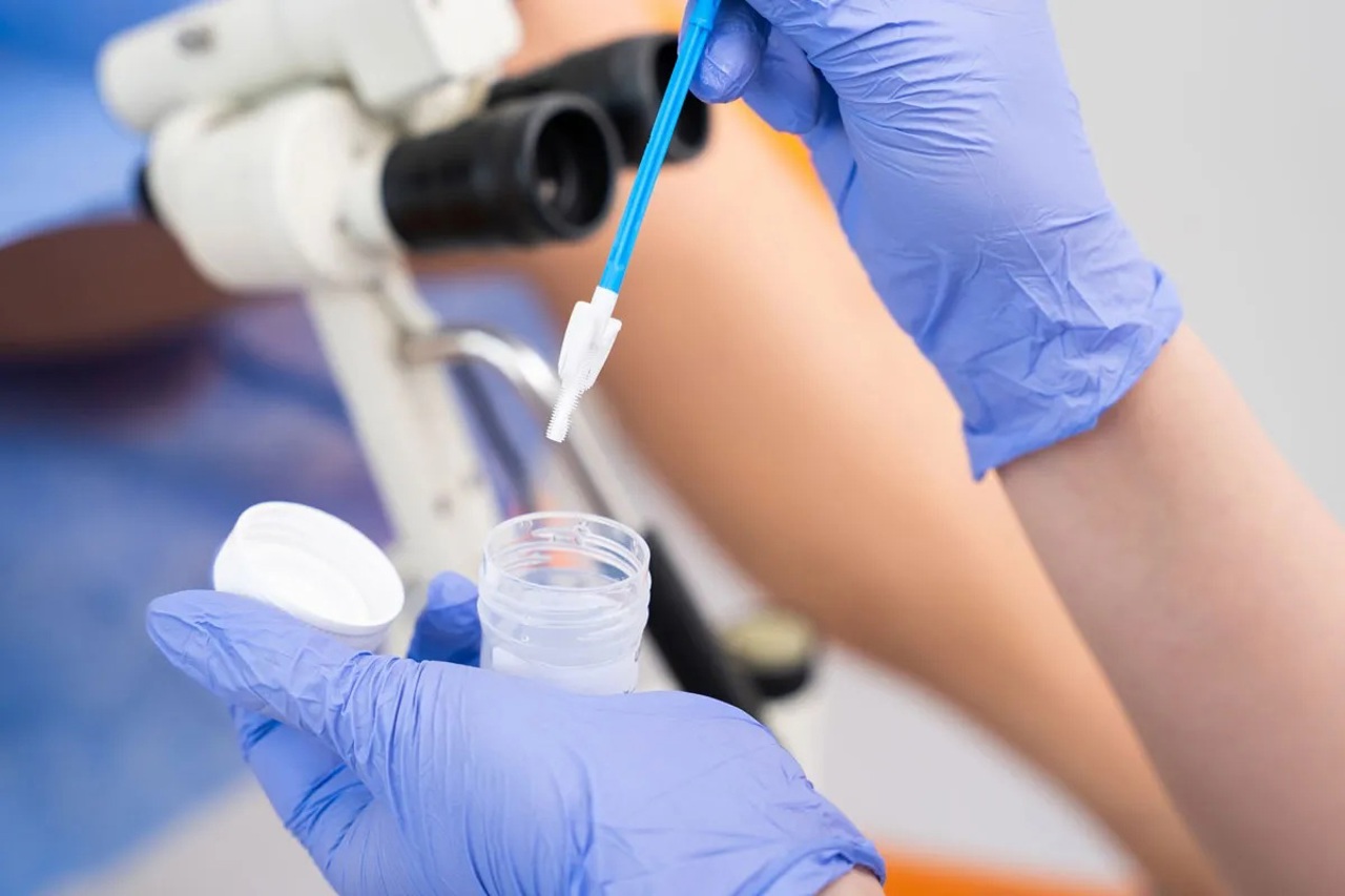 În R. Moldova, 160 de femei mor anual de cancer de col uterin. Medic: „Regretabil pentru o țară unde testul Papanicolau este gratuit” 