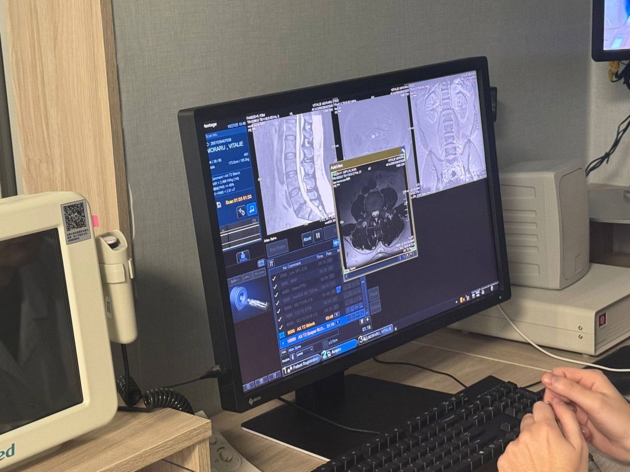 Cabinet RMN la Institutul de Neurologie și Neurochirurgie: peste 3.000 de investigații vor fi efectuate anual