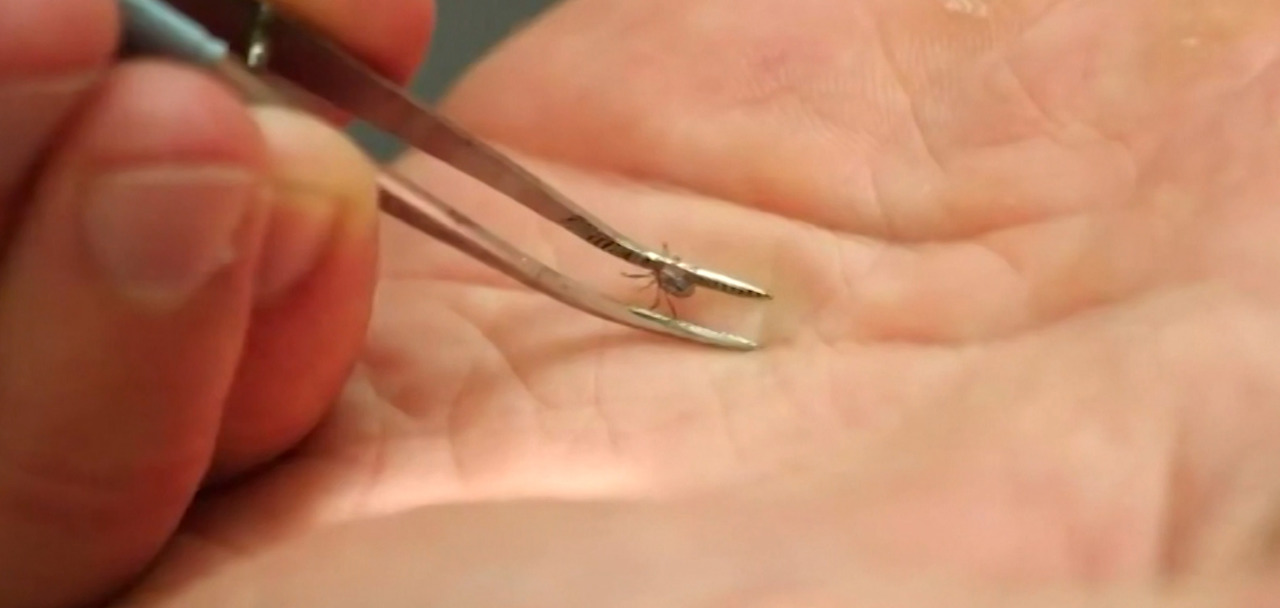 Beware of ticks: Nearly 160 Lyme disease cases reported last year