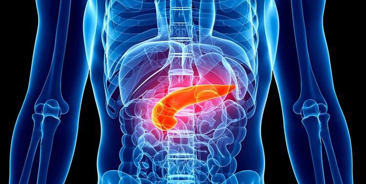 „Afecțiunea care nu doare”: Pancreasul gras poate avea complicații grave