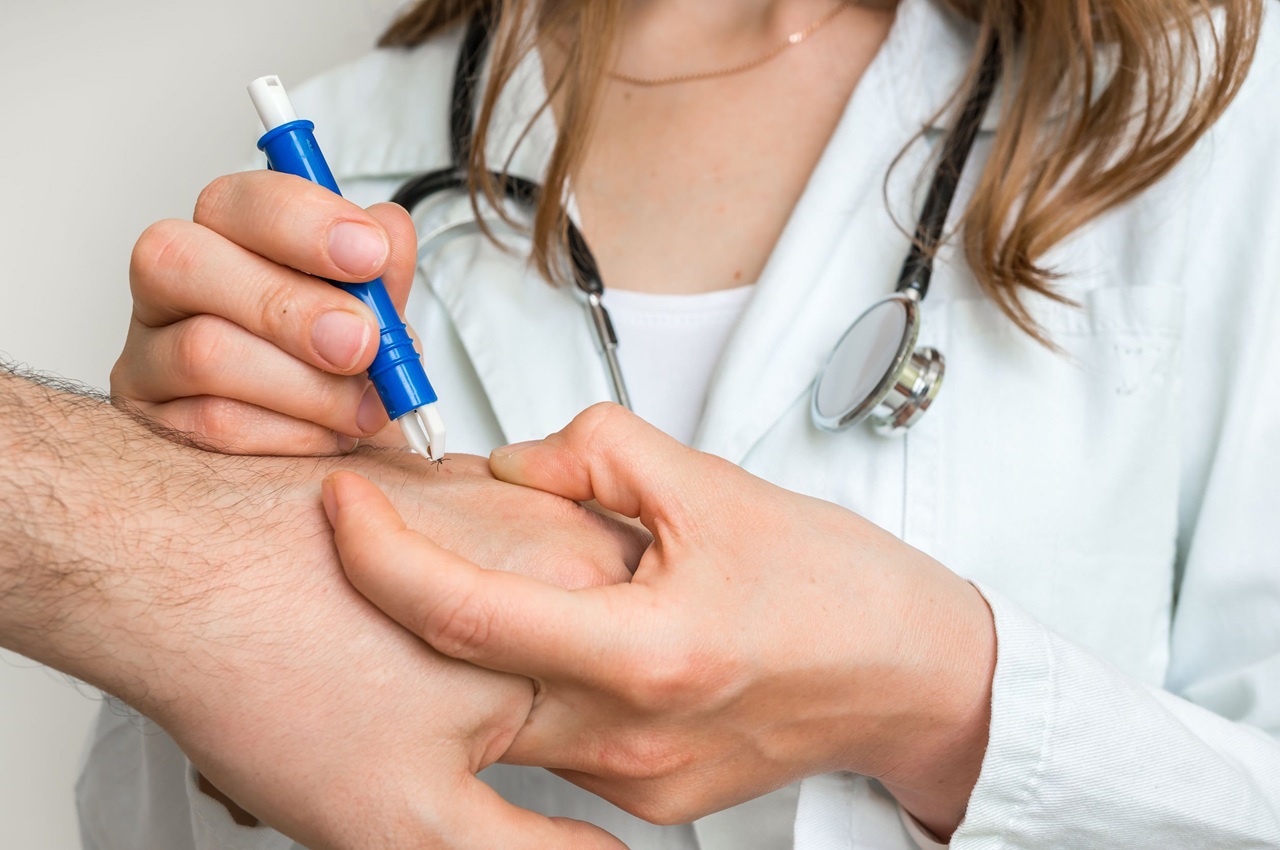 Three Lyme disease cases reported in Chisinau from tick bites