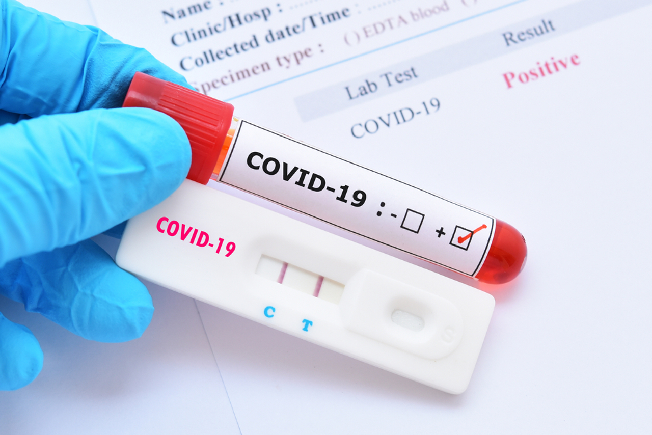 Experts urge caution as Moldova sees rise in COVID-19 cases