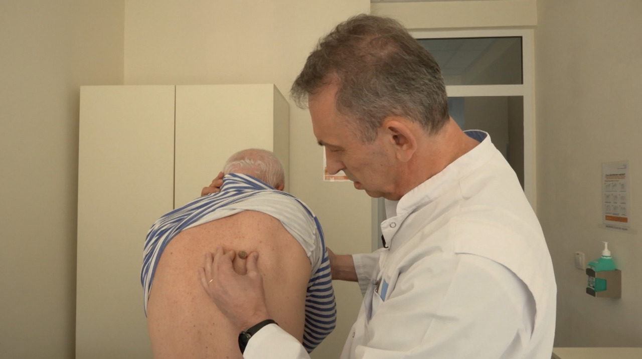O aluniță ignorată poate costa scump: Medicii recomandă verificarea modificărilor pielii