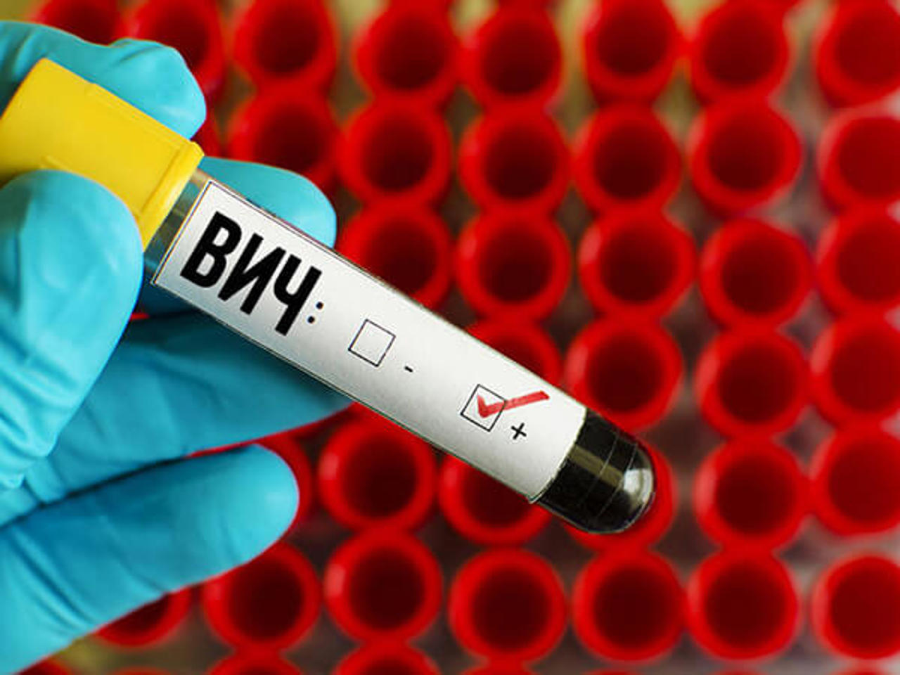 Диагноз ВИЧ - не приговор: история Андрея Столяренко, узнавшего о болезни случайно