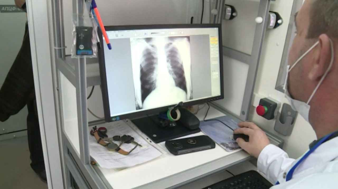 Pneumonia, pericol major pentru pacienții care se adresează prea târziu la medic