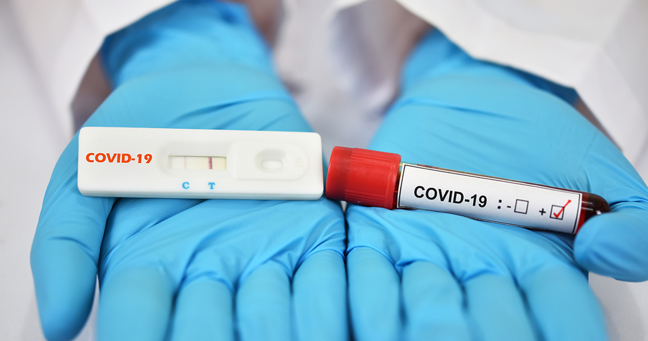 Number of cases of COVID-19 is increasing in Chisinau