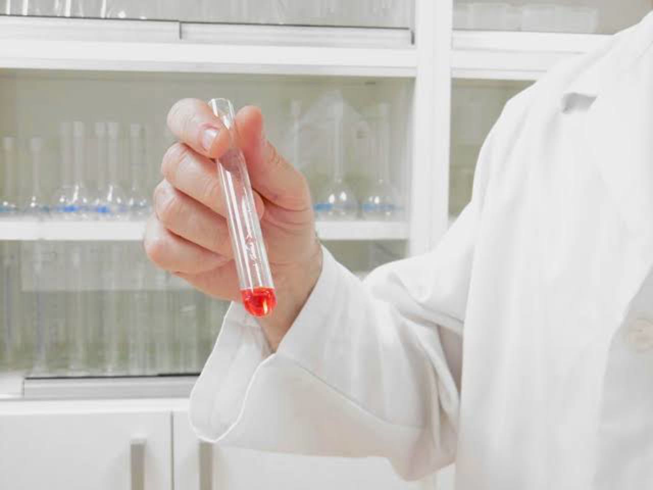 Russian researcher dies as Moscow denies Siberian plague leak 