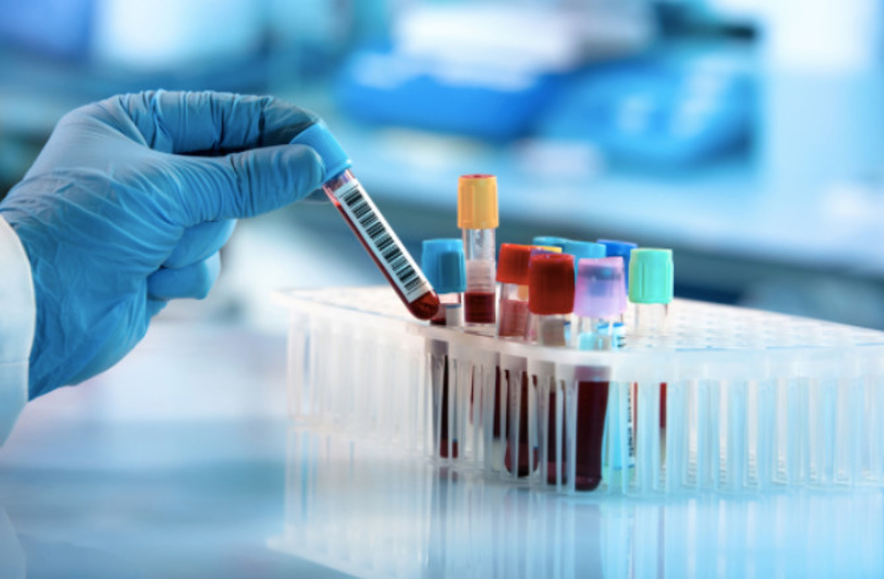 Program național nou: Cel puțin 95% dintre cazurile de HIV și hepatite virale, depistate și tratate până în 2030 