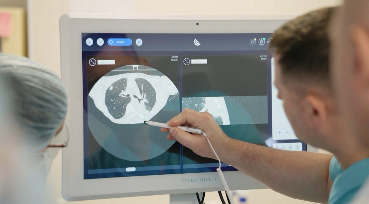 Primele intervenții robotizate de prelevare a biopsiilor pulmonare, realizate de medicii Institutului Oncologic 