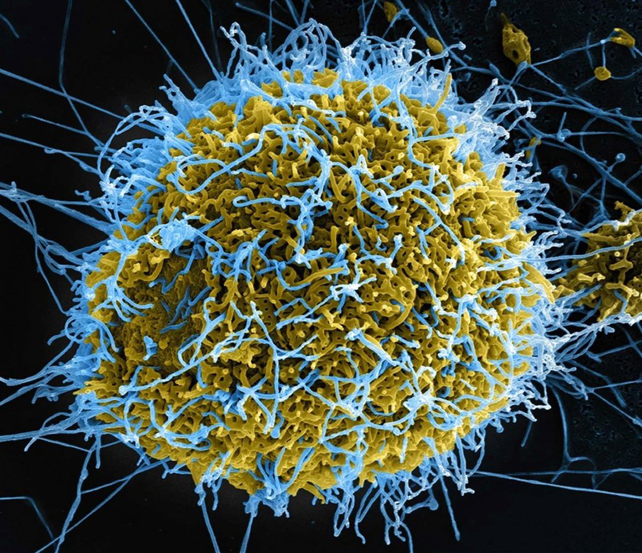 Ebola: Peste 200 de decese în Republica Dominicană Congo, zece țări africane prezintă riscuri