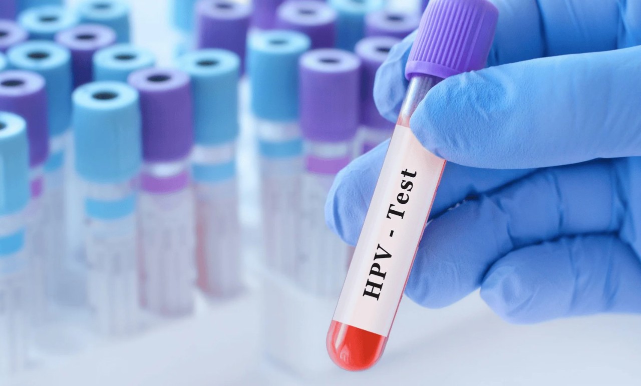 De la testul PAP la HPV: R. Moldova testează o nouă metodă de depistare a cancerului de col uterin