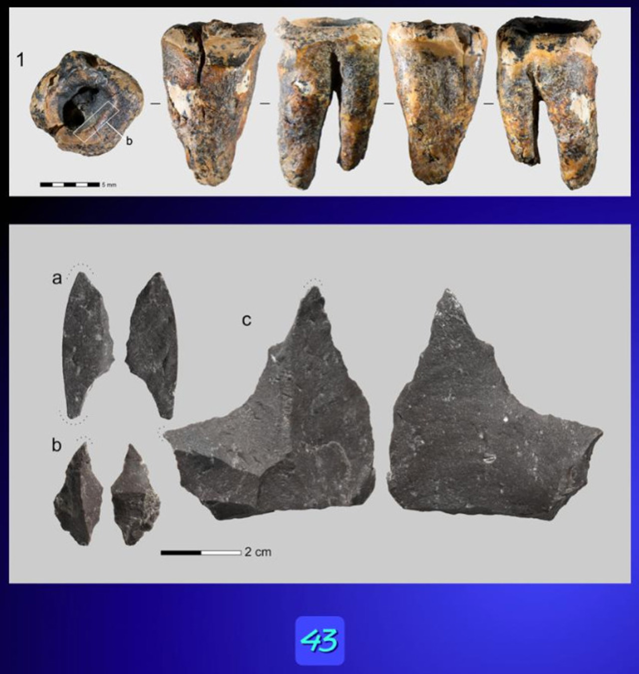 Neanderthalienii aveau „dentiști” acum 59.000 de ani, susțin cercetătorii