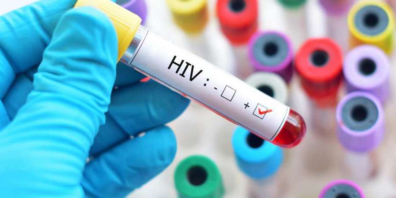 In 2024, Moldova reported 880 new HIV cases